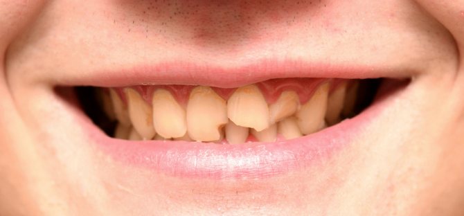Лучшие продукты для здоровых зубов | блог клиники dentaprime