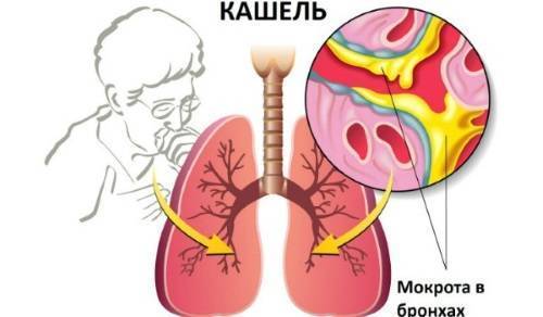 Опасные осложнения туберкулеза легких