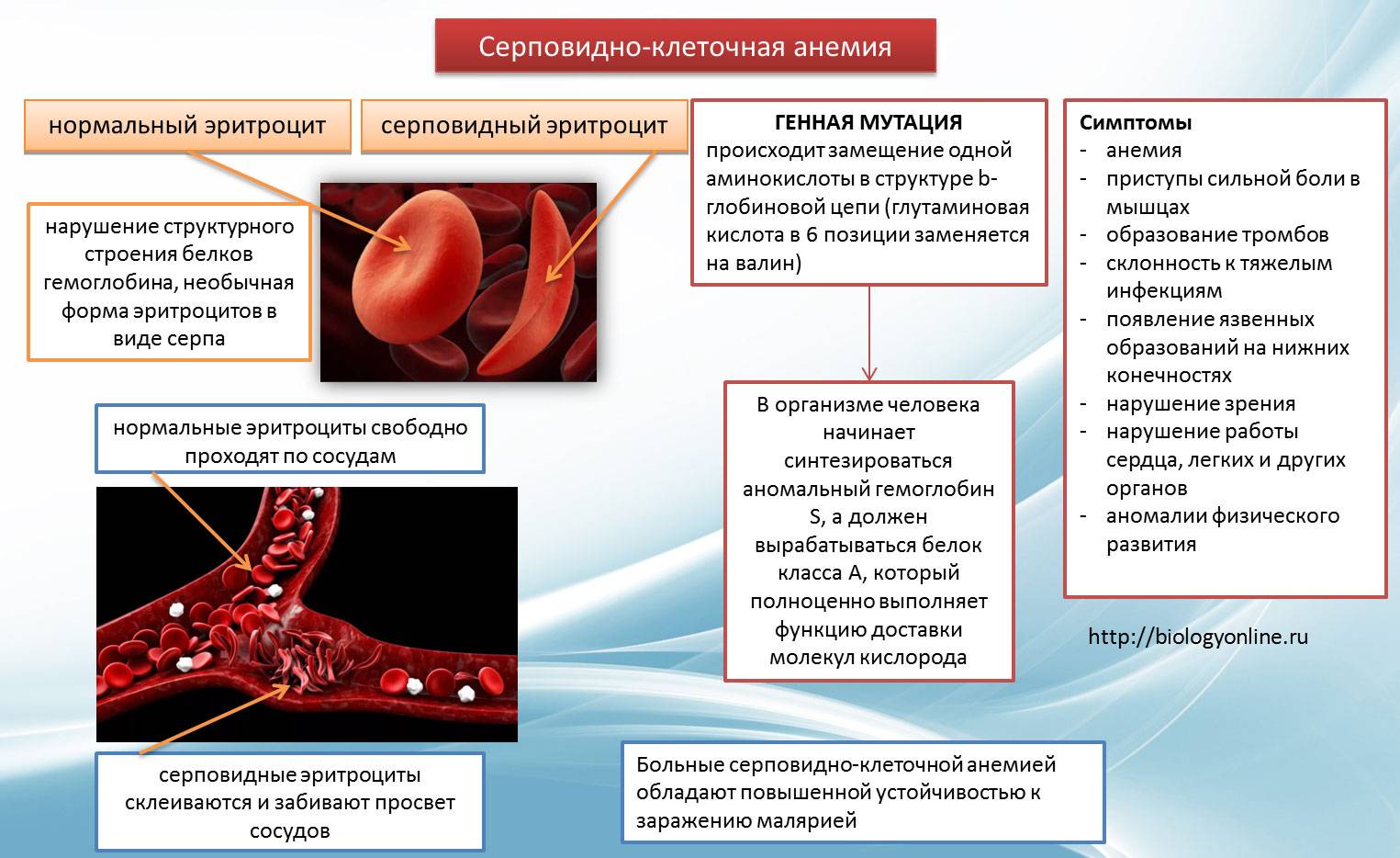 Серповидноклеточная анемия этиология