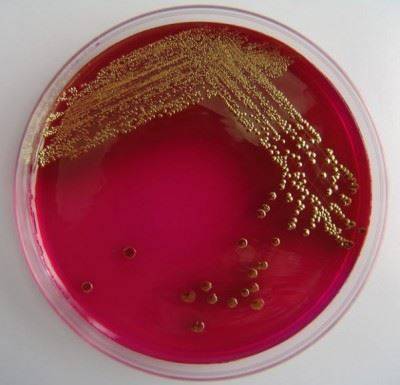 Bacillus subtilis (cенная палочка)