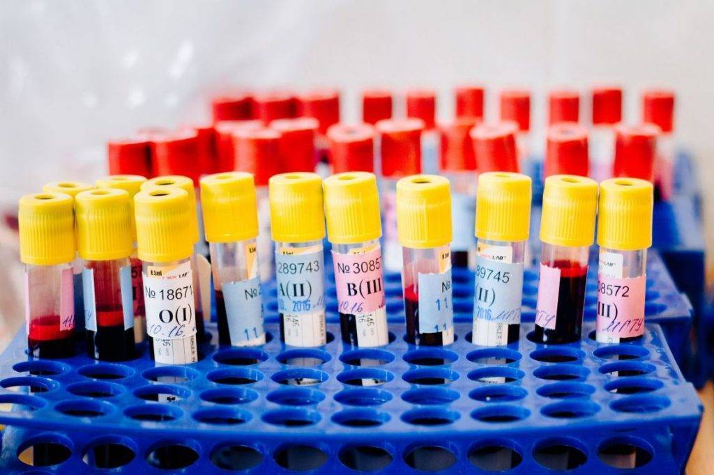 Правильно сдать анализ крови на гепатиты thumbnail