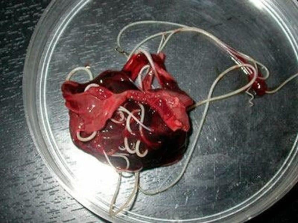 Цирроз печени от паразитов thumbnail