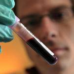 Генетический анализ крови на Синдром Жильбера: тесты и расшифровка