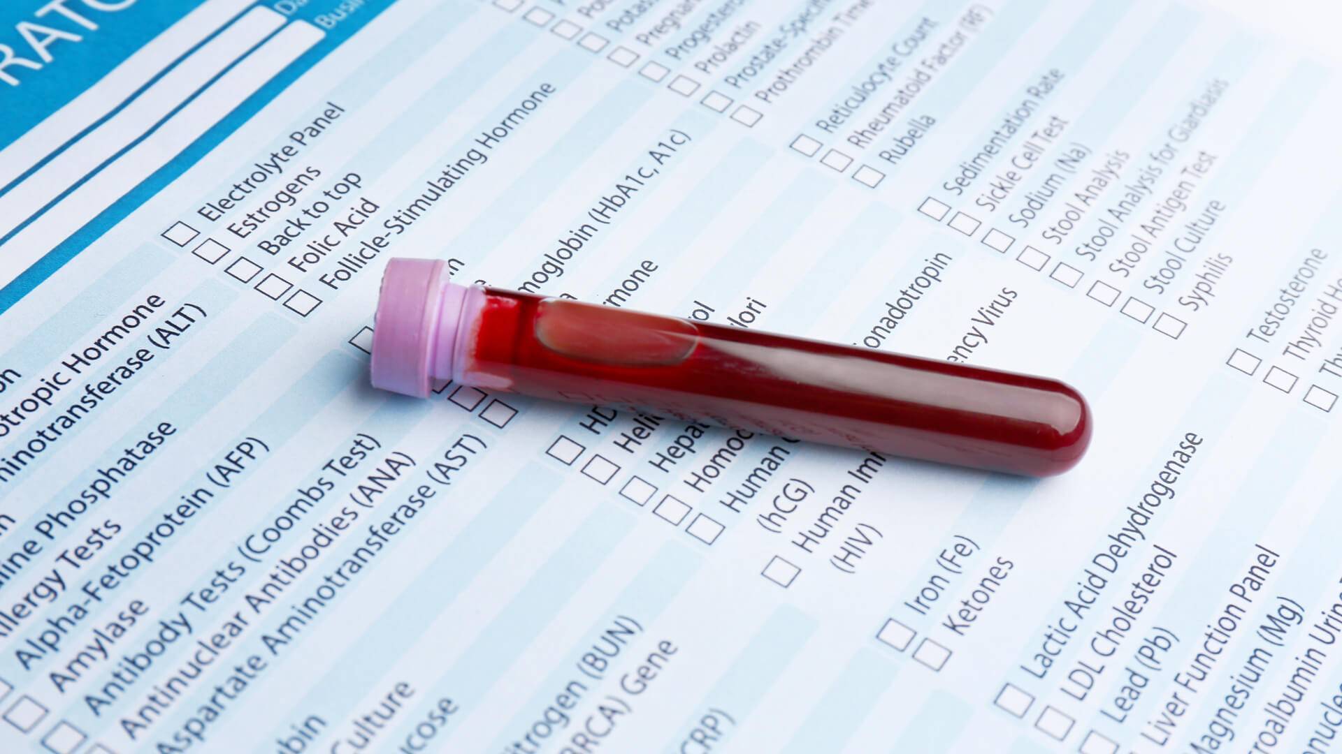 Анализ крови на билирубин и трансаминазы thumbnail
