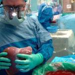 Сколько живут после трансплантации печени при циррозе?