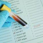 Как называется анализ крови на гепатит?