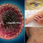 Опасен ли гепатит C для окружающих?
