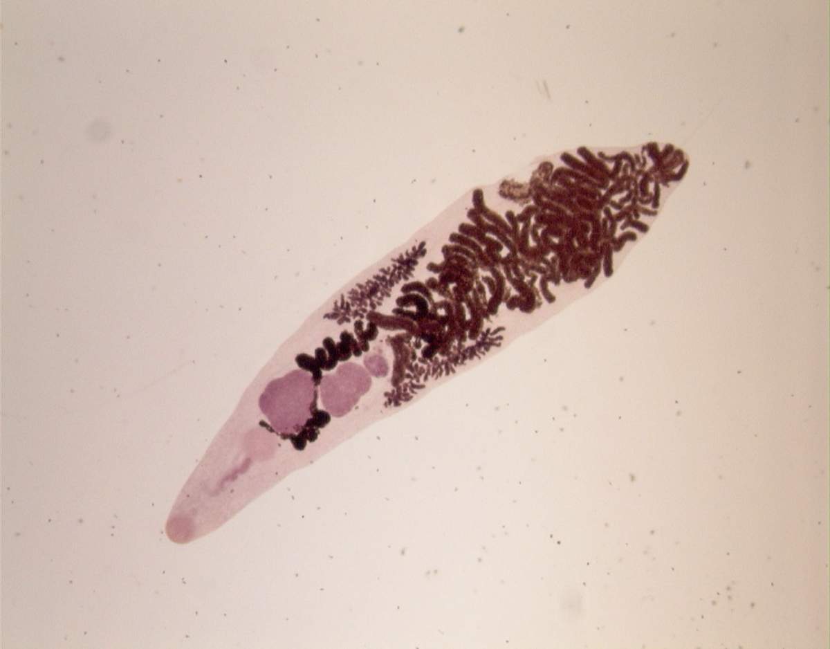 Двуустка ланцетовидная (Dicrocoelium lanceatum)–