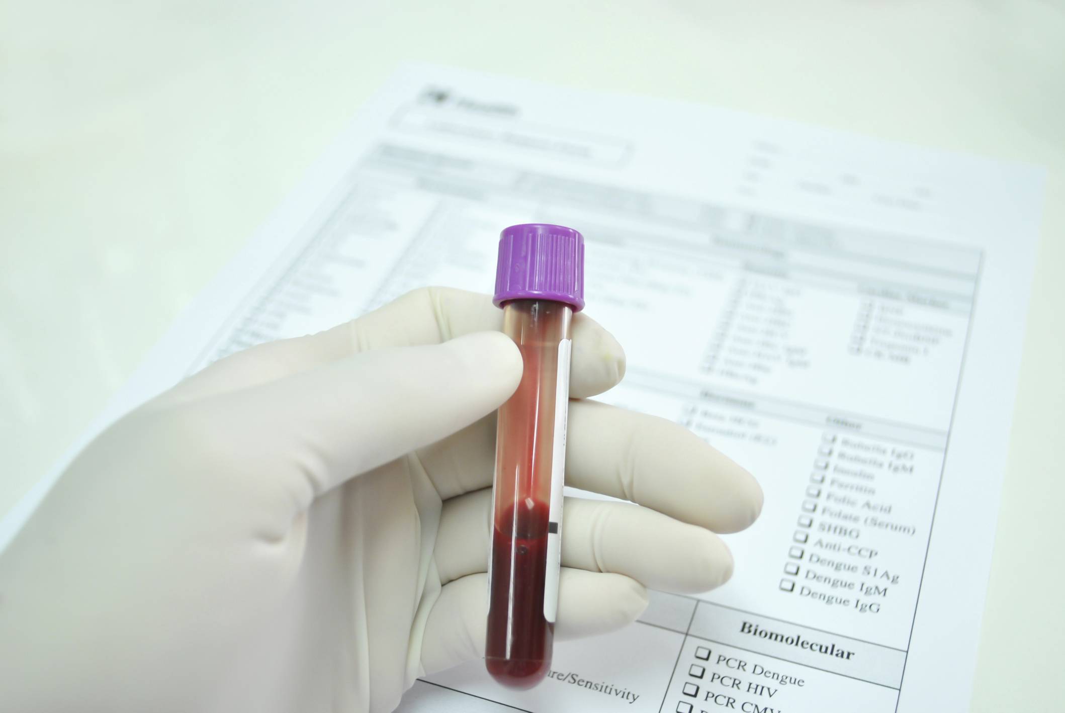 Этапы анализа крови