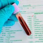 Криптогенный гепатит: причины, диагностика, лечение
