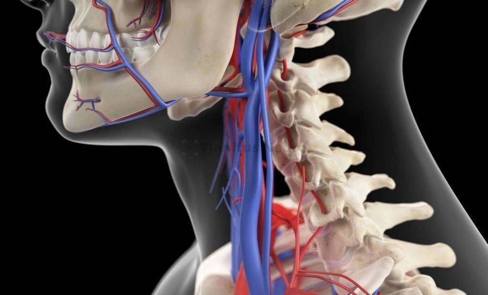 Синдром позвоночника. Позвоночная артерия шейного отдела. Стеноз позвоночной артерии. Рентген позвоночной артерии. Анатомия позвоночной артерии в шейном отделе.