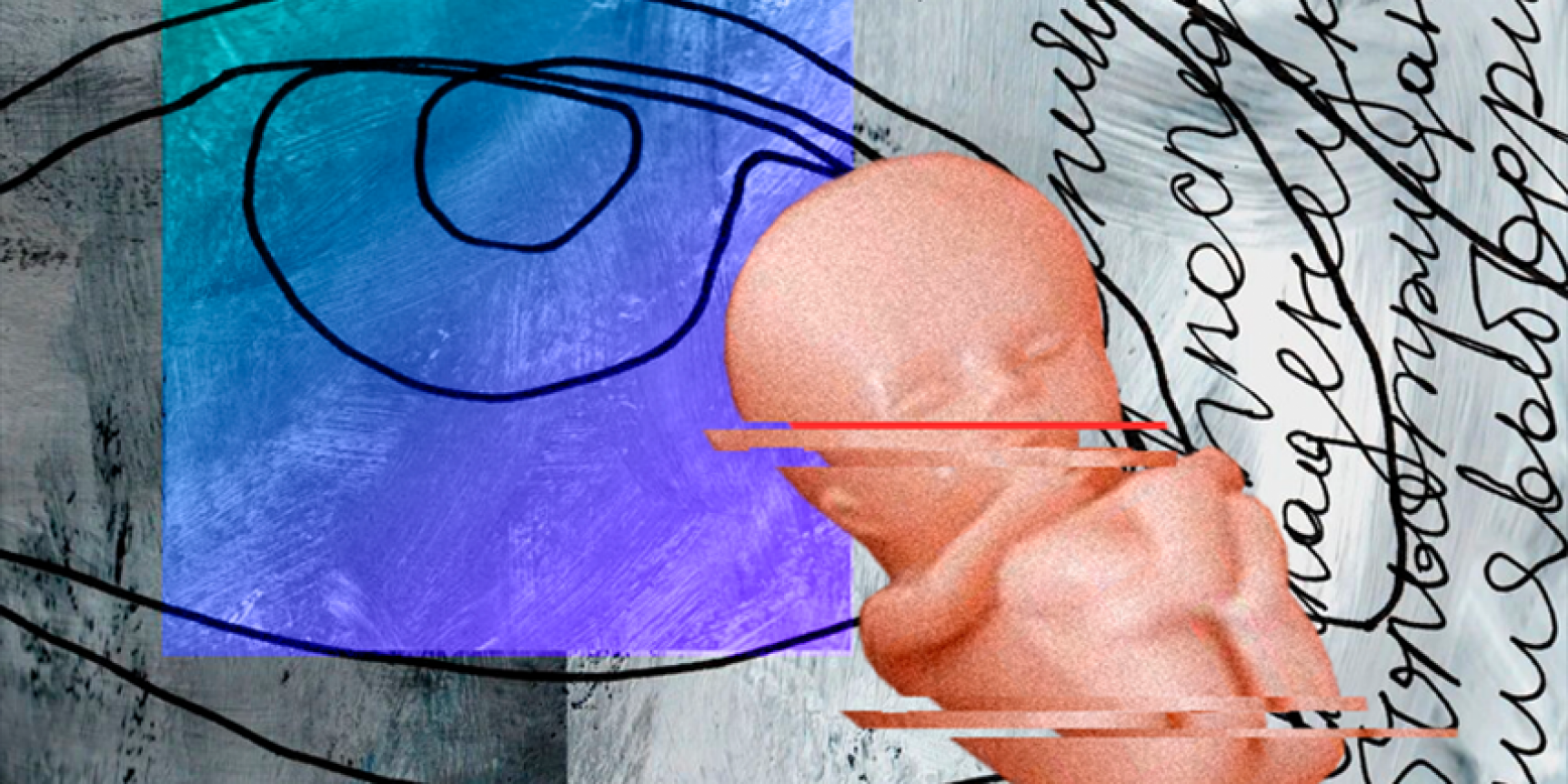 Принять таблетку vs сохранить беременность? как проходит медикаментозный аборт