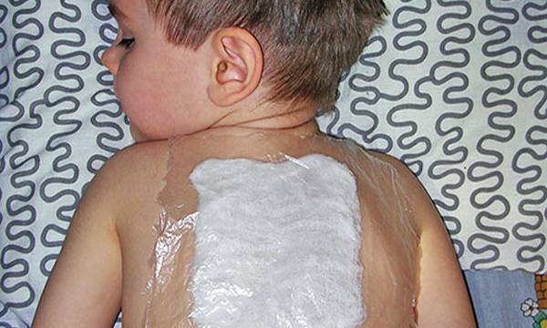 Капустный лист с медом от кашля для детей: особенности лечения