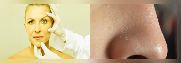 Лечение гипотиреоза щитовидной железы у женщин