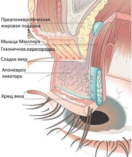 Как избавиться от птоза верхнего века