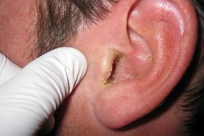 Почему чешутся уши: заболевания и приметы