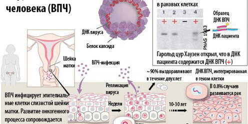 Все, что нужно знать про вирус папилломы человека