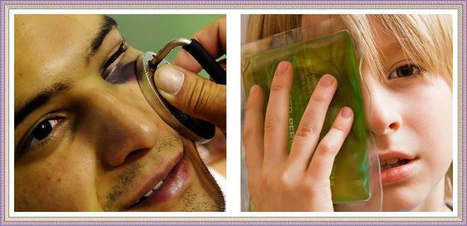 5 эффективных мазей от синяков и гематом на лице: что помогает при ушибах