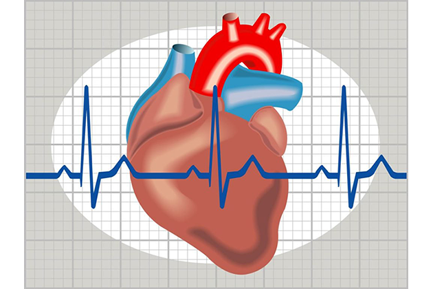 Что такое аритмия сердца? причины и лечение аритмии