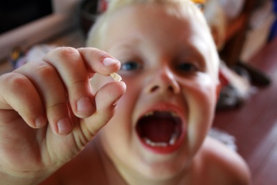 Какие зубы меняются у детей на коренные или схема выпадения молочных зубов у детей и сколько выпадает