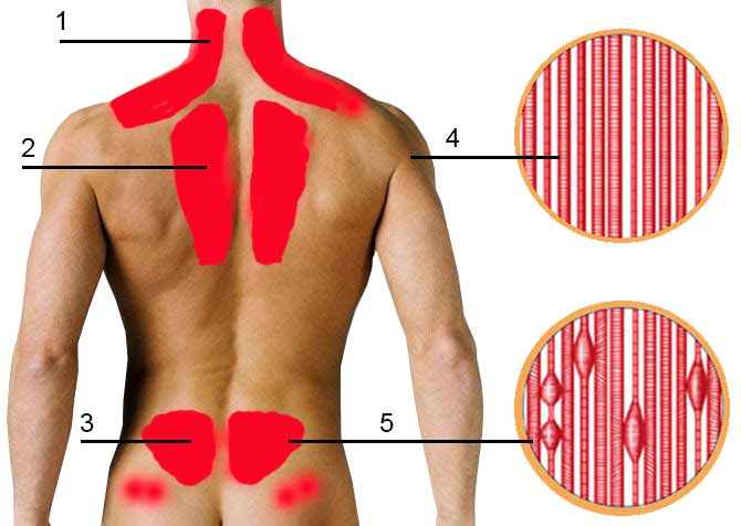 Боли в спине в области лопаток. причины, лечение – препараты и упражнения