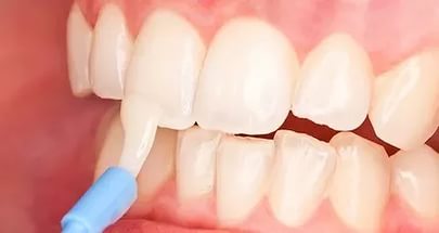 Настоящие зубы. ученые смогли восстановить эмаль - korrespondent.net
