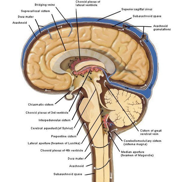 Гидроцефалия головного мозга у взрослых: причины, симптомы, лечение