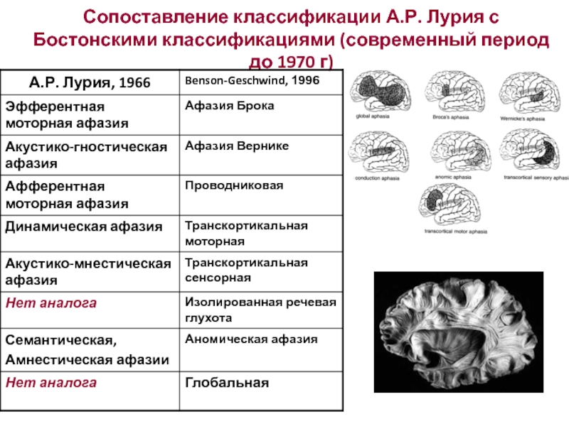 Эфферентная моторная афазия пример