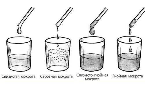 Как выплюнуть мокроту при кашле