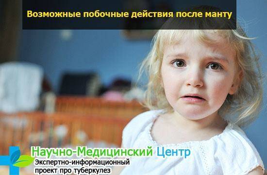Манту при рвоте - запись пользователя екатерина (leonid157) в сообществе здоровье - от трех до шести лет в категории прививки, манту и проч - babyblog.ru