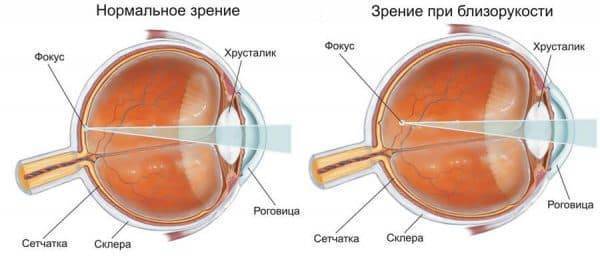 7 врожденная и приобретенная патология органов зрения
