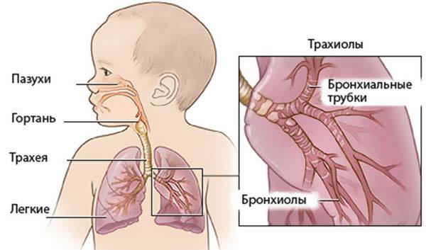 Как распознать симптомы пневмонии у детей с температурой