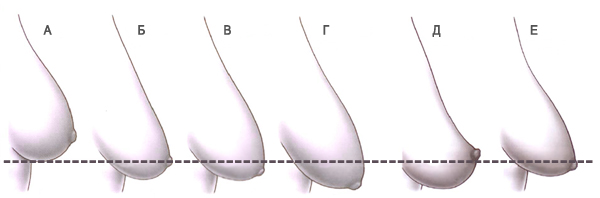 Как подтянуть грудь после грудного вскармливания?