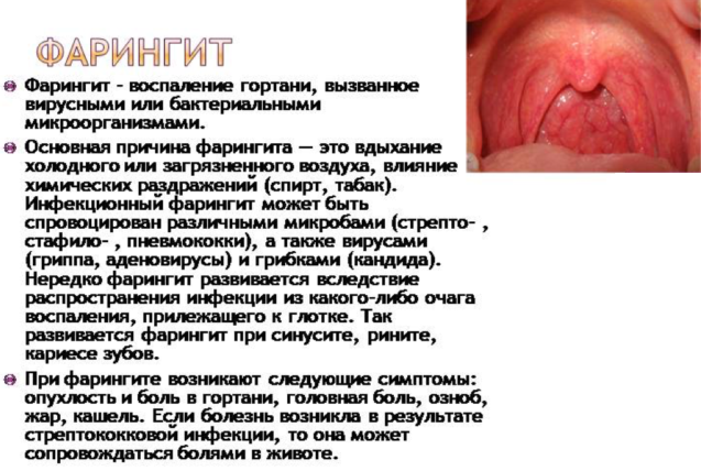 Развитие и симптомы грибковой инфекции в горле