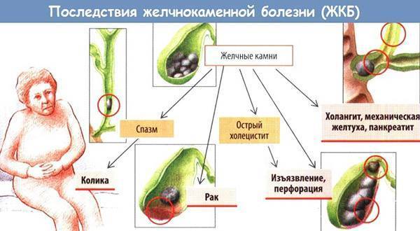 УРСОСАН