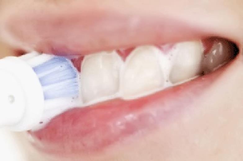 Как восстановить эмаль зубов:  стоматология и лечение зубов у беременных мам и детей