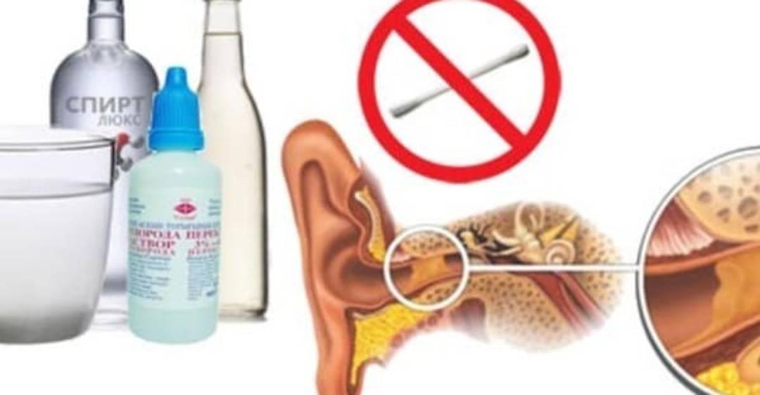 Почистить уши перекисью водорода в домашних условиях. Как правильно очистить уши от серы в домашних условиях. Промывание ушных пробок. Промывание ушей от серных пробок.