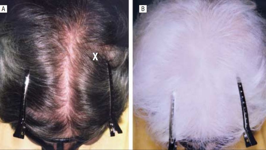 Психосоматика седых волос: истинные причины, почему мы седеем :: инфониак
