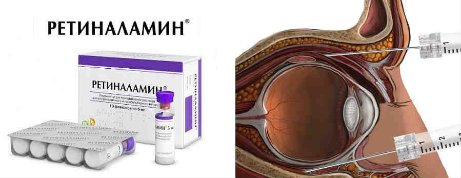 Ретиналамин (retinalamin) уколы для глаз. отзывы, инструкция по применению, цена