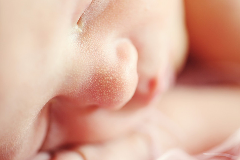 У новорожденного облазит кожа: почему слезает на теле, в паху, на руках и лице у грудничка