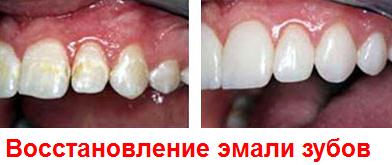 Настоящие зубы. ученые смогли восстановить эмальсюжет