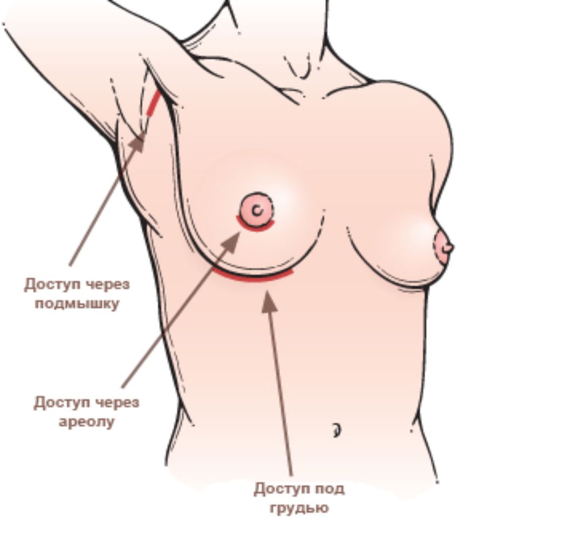 Как сохранить грудь упругой: 7 способов, которые не работают