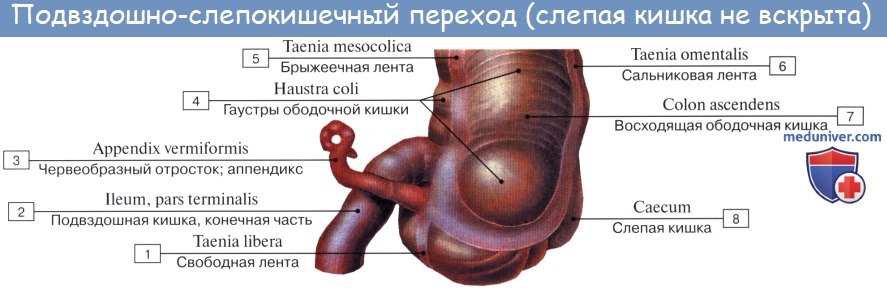 Особенности клинической картины острого аппендицита при тазовом расположении червеобразного отростка