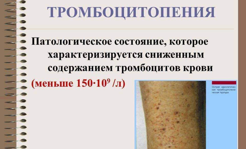 Капилляротоксикоз фото и симптомы и лечение Карбамазепин - 14 отзывов, инструкция, аналоги, цена 64 руб