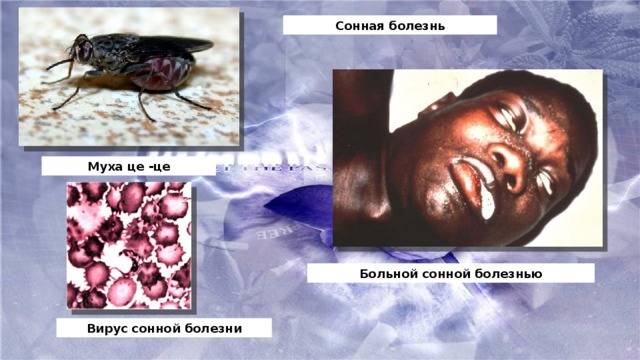 Сонная болезнь и болезнь шагаса (африканская и американская трипаносомы): жизненный цикл, симптомы, лечение