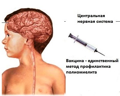 Живая полио 5летнему ребенку,высадка из группы - запись пользователя мария (id2094475) в сообществе мы против прививок! в категории полиомиелит - babyblog.ru