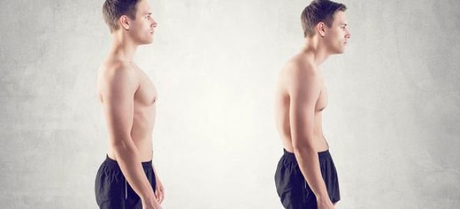 Кифоз позвоночника грудного и шейного отдела: лечение и упражнения