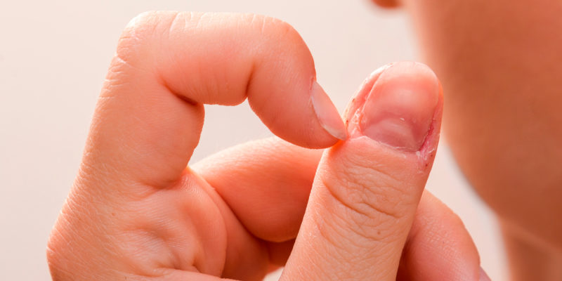 Как лечить заусенцы на пальцах: просто и понятно