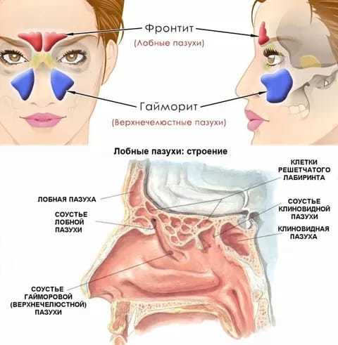 Фронтит лобных пазух. Лобная пазуха клиновидная пазуха. Клиновидная пазуха и гайморова пазуха. Носовая полость гайморовы пазухи строение.