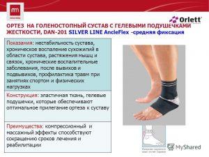 Восстановление и реабилитация связок коленного сустава после травмы | все о суставах и связках